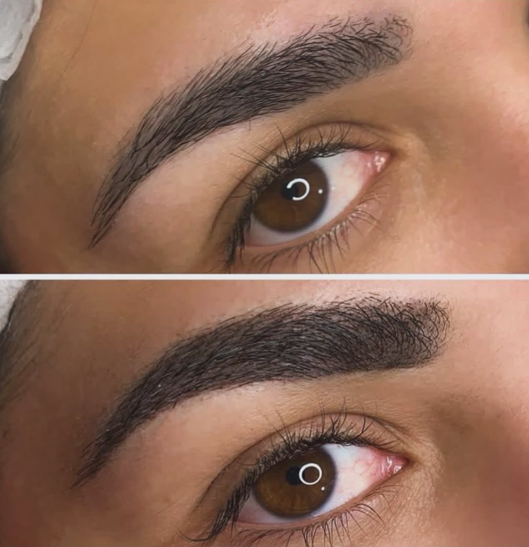 Antes e depois — Volume e forma