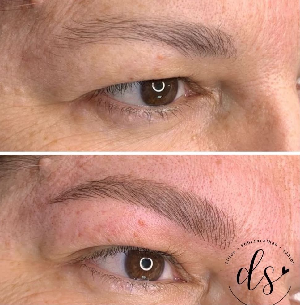 Antes e depois — Redesenho