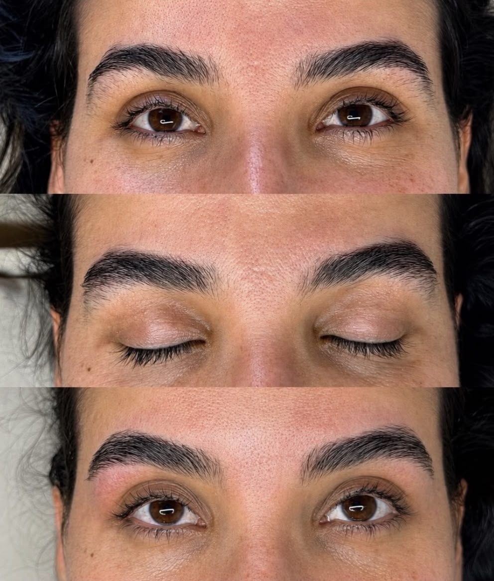 Antes, durante e depois — Brow lamination