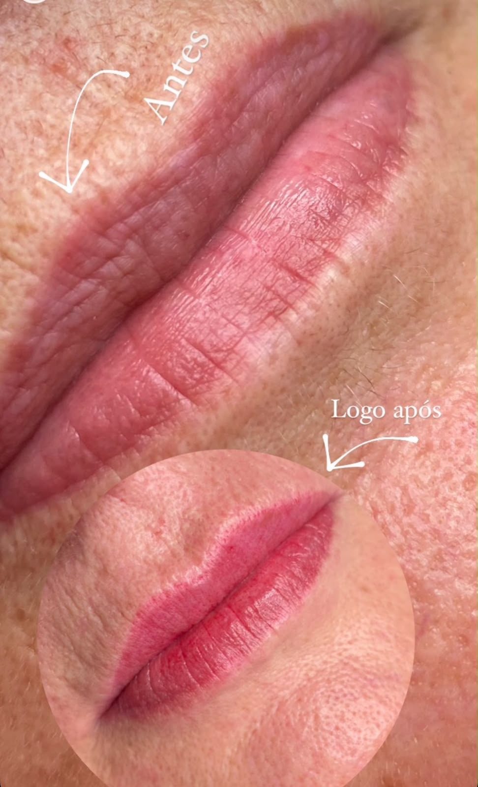 Antes e logo após — Lip blush